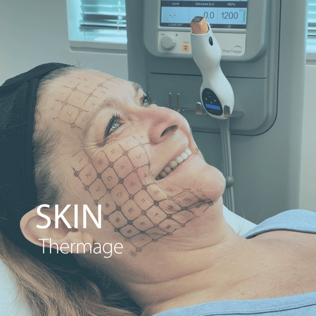 Thermage
